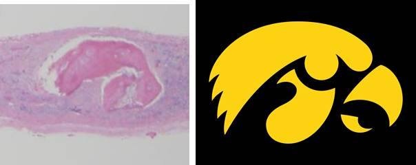 Herky Tissue 2014