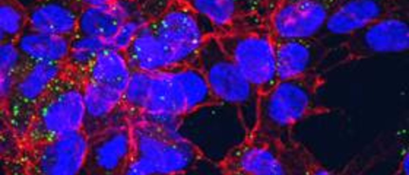 cells with particles