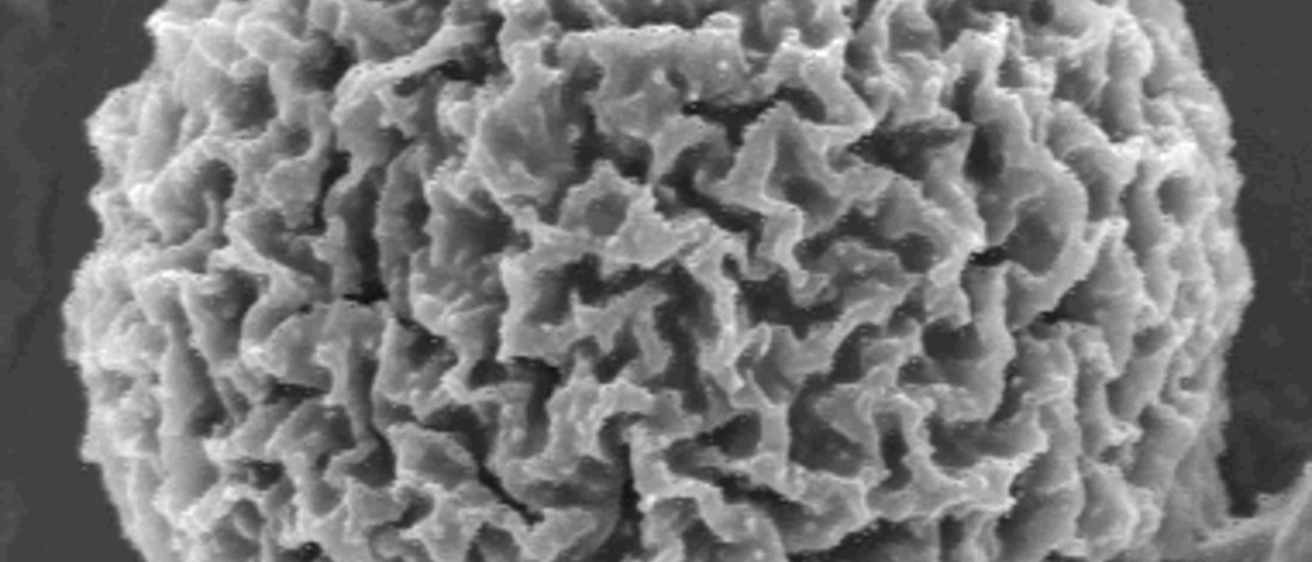 porous particle