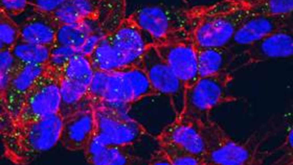 cells with particles